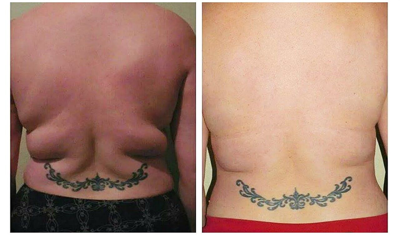 videos de ejercicios para quemar grasa dela espalda videos de ejercicios para quemar grasa dela espalda