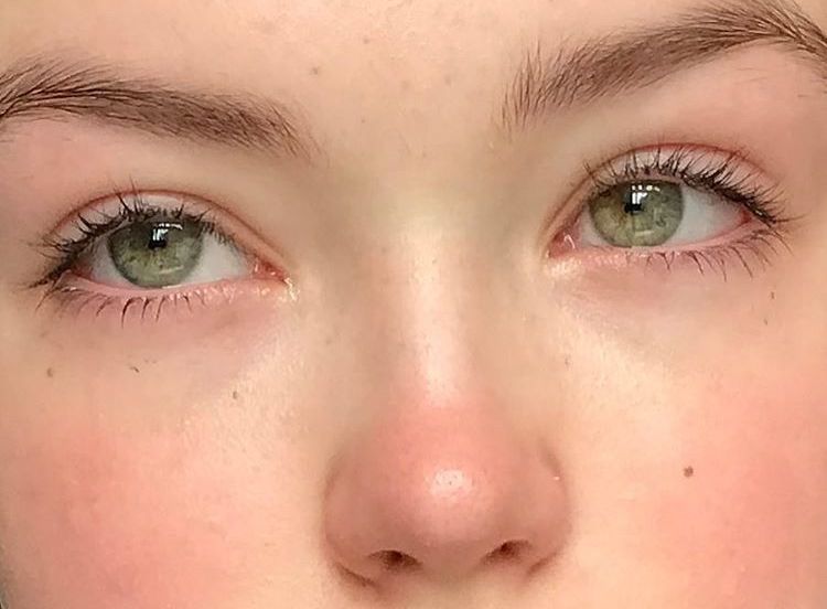 Pin By Serenay On Surgeries Aesthetic Eyes Aesthetic Makeup Makeup Inspiration Pin By Serenay On Surgeries Aesthetic Eyes Aesthetic Makeup Makeup Inspiration