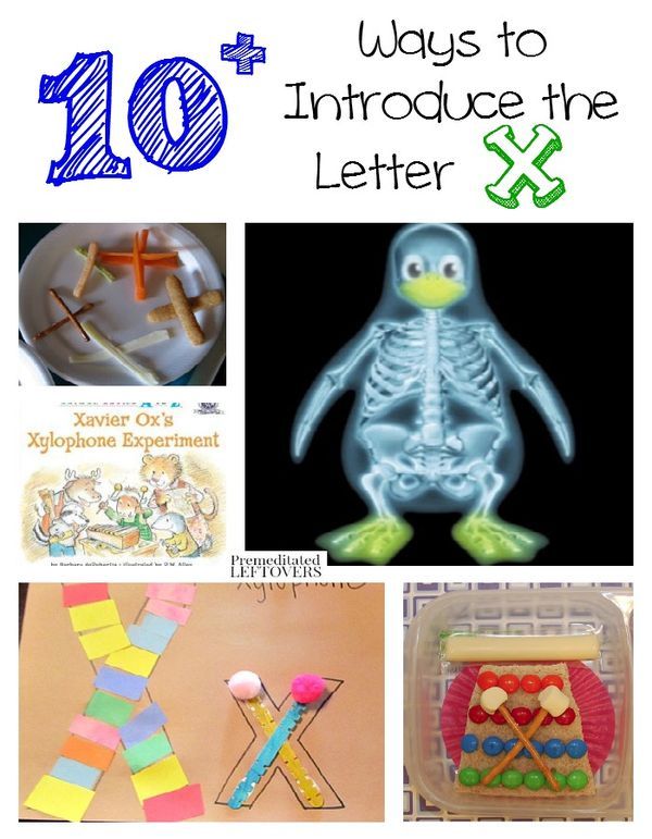 Are you stuck on activities to teach the letter X? Here are 10+ ways to