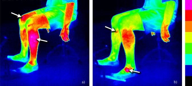 LME Muscle Temperature Elevated Temperatures Will Decrease LME Bbecaue LME Muscle Temperature Elevated Temperatures Will Decrease LME Bbecaue