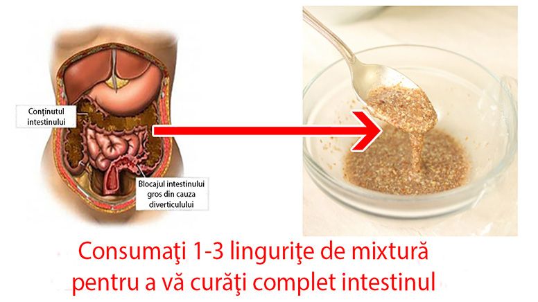 detox curățarea intestinului