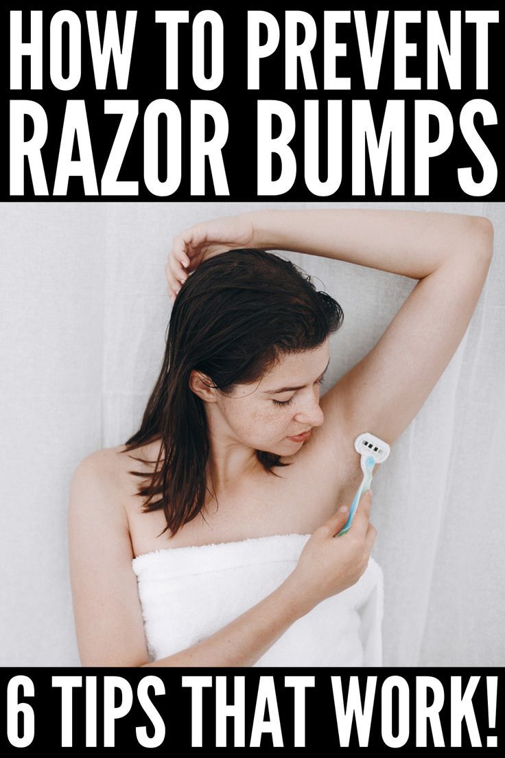 Shaving 101 6 Home Remedies For Razor Bumps That Work Artofit