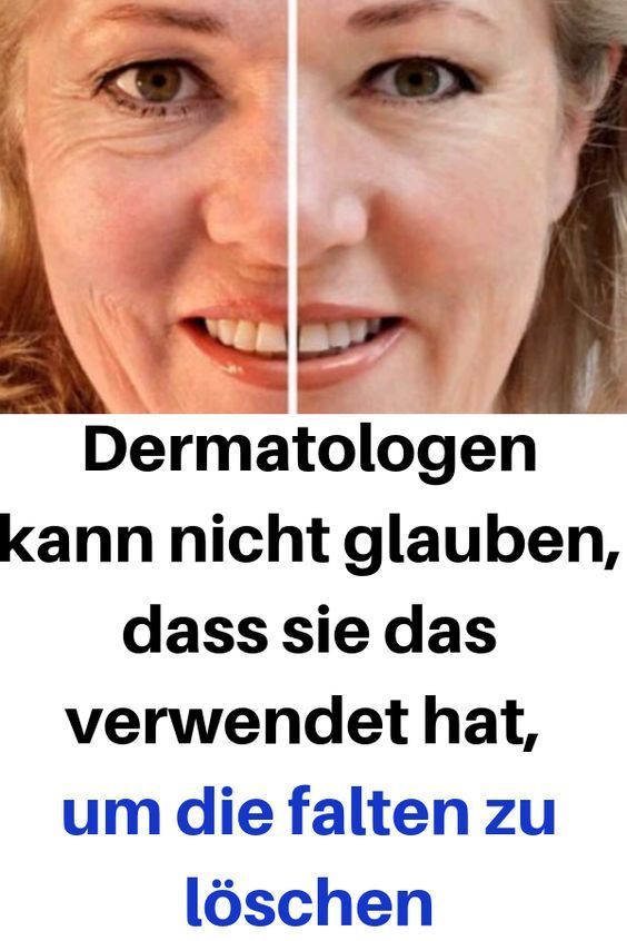 Dermatologen kann nicht glauben, dass sie das verwendet hat, um die falten zu l..., #Das #dass #Der...