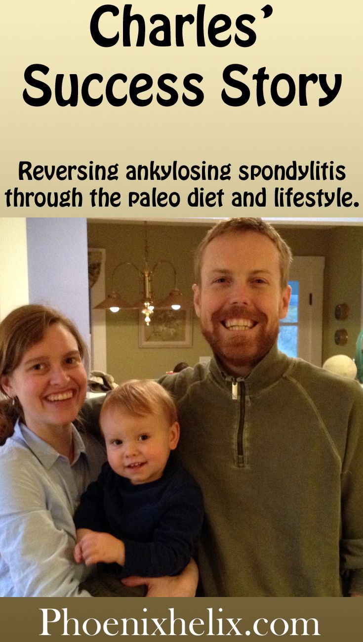 2019 year - Michaels Ankylosing Spondylitis Story: A Diagnosis Delayed 2019 year