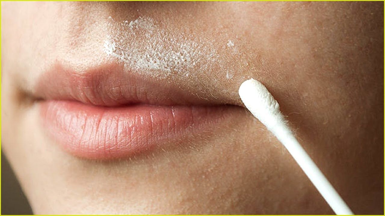 How To Get Rid Of Upper Lip Lines Permanently 2 How To Get Rid Of Upper Lip Hair Naturally At Home Upper