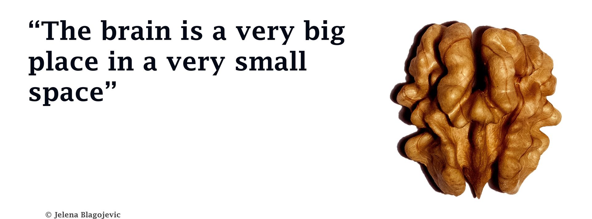 The brain is a very big place, in a very small space\ The brain is a very big place, in a very small space\