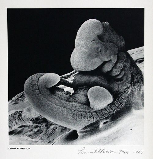 110 The Changes Of Growth Fmp Ideas Sculpture Art Birth Art Human Embryo