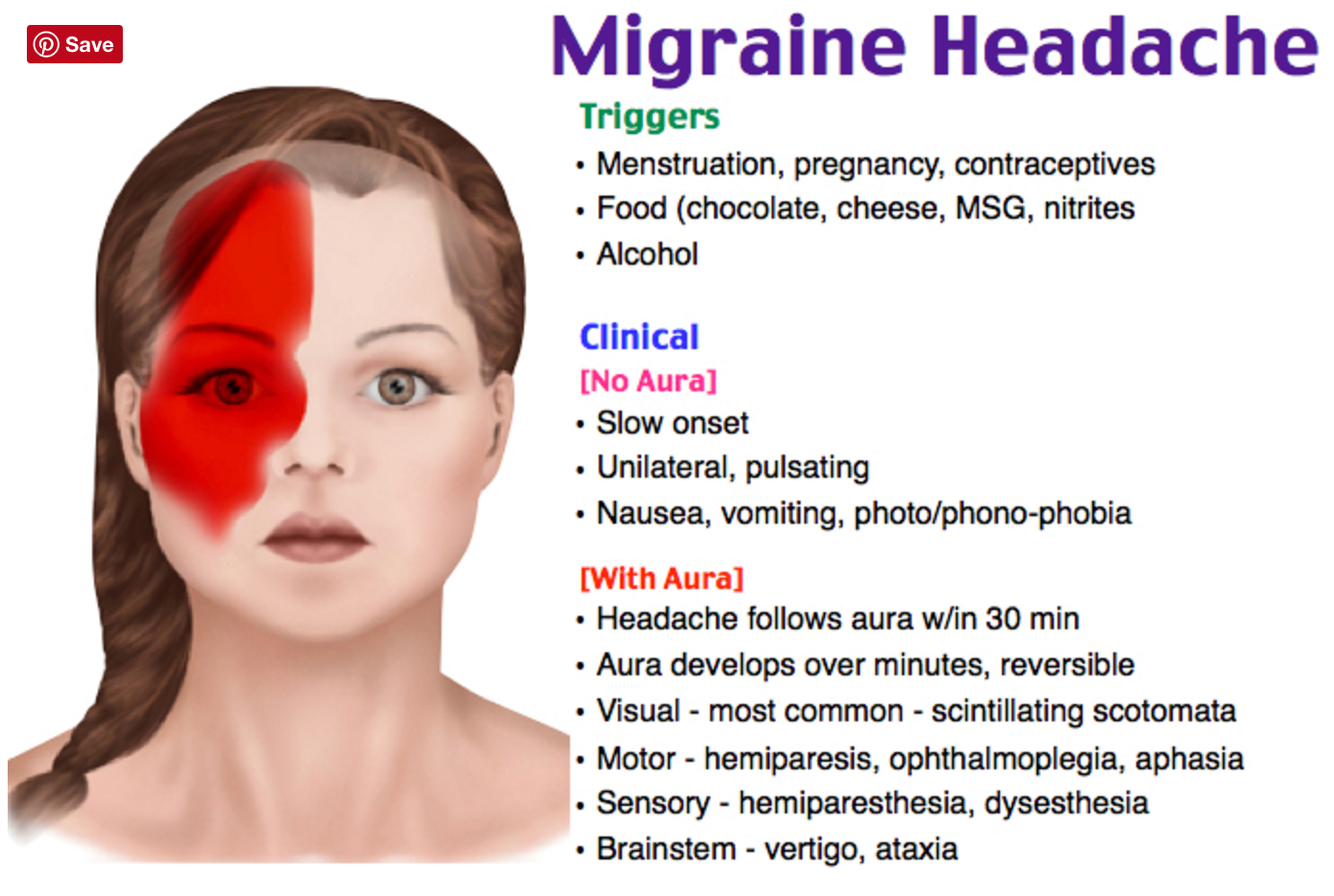 Pin By Vi Levy On Study Medicine Migraine Headaches Headache Migraine