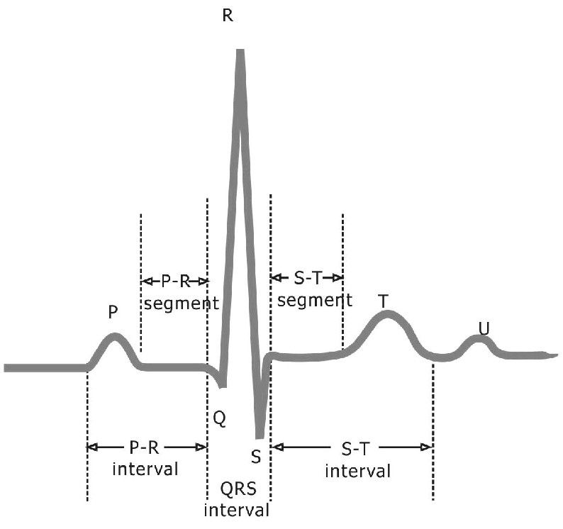 description ecg pqrst u nurse life nursing students pqrst