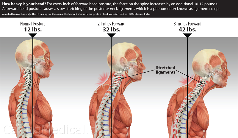 Symptoms and conditions of Craniocervical and Cervical Instability -