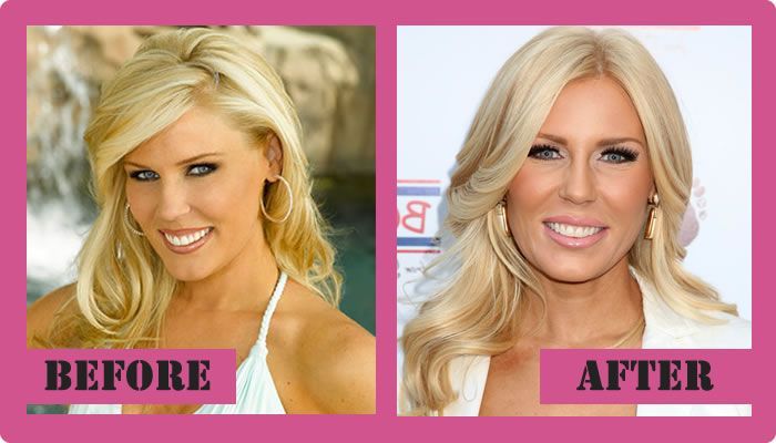 Gretchen did have a boob job Spank the monkey mastrabate