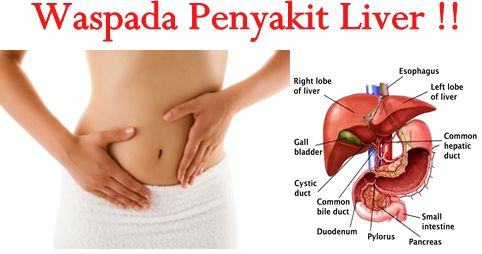 Cara Alami Mengatasi Penyakit Liver Vitanona Penyakit Bau Badan Alkohol