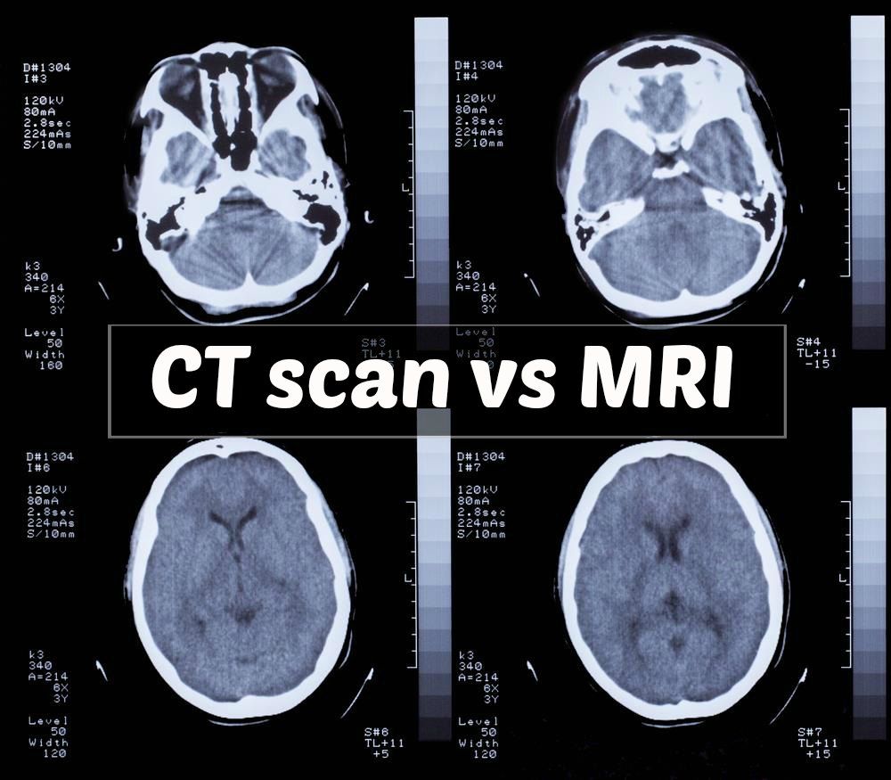Mri Ct Scan Mri Scan