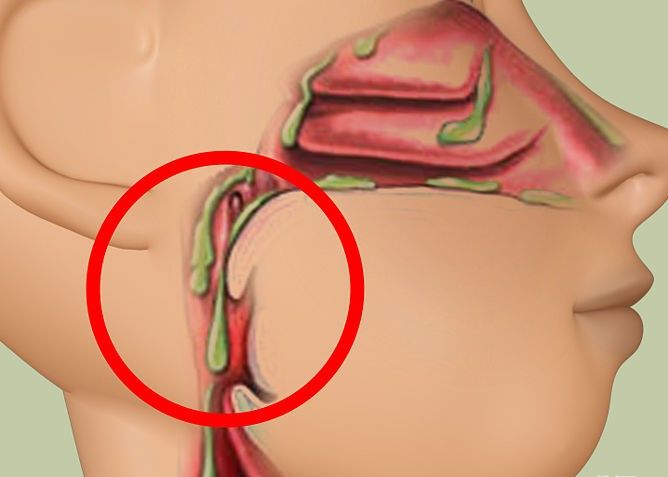 SEX WITH FUR Fat Loss Programmes