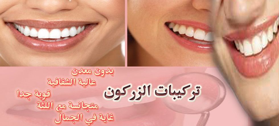 تجميل الأسنان باب جديد من أبواب التجميل التي يمكن اللجوء إليها في سبيل الوصول إلى طل ة مكتملة الجمال وأنيقة على حد سواء ولم يعد يقتصر الأمر على عملية تبييض الأ