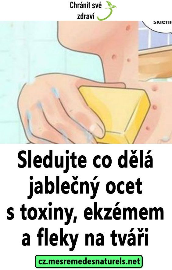 Sledujte co dělá jablečný ocet s toxiny, ekzémem a fleky na tváři Healthy Tips, Healthy Recipes, Organic Remedy, Natural Care, Natural Living, Herbal Remedies, Feel Better, Fat Burning, Diabetes