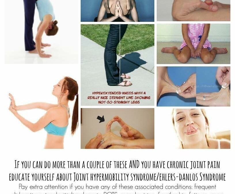 Joint Hypermobility, Hypermobility Syndromes and Ehlers-Danlos syndrome - Hypermobility Type - EDS Wellness, Inc. Ehlers Danlos Syndrome Symptoms, Ehlers Danlos Hypermobility, Elhers Danlos Syndrome, Pelvic Congestion Syndrome, Chiari Malformation, Chronic Fatigue, Chronic Illness, Chronic Pain, Invisible Illness