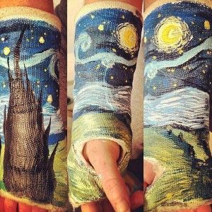 Diseño En Todas Partes Férulas Y Yesos Intervenidos Yeso En El Brazo Disenos De Unas Klimt Pinturas