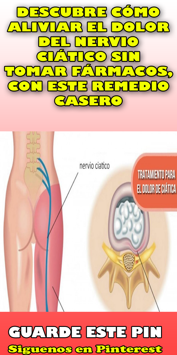 Ciatica tratamiento casero