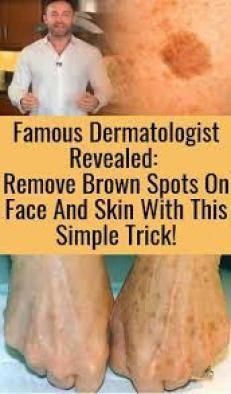 Find Out Who is Worried About Remove Brown Spots a Find Out Who is Worried About Remove Brown Spots a