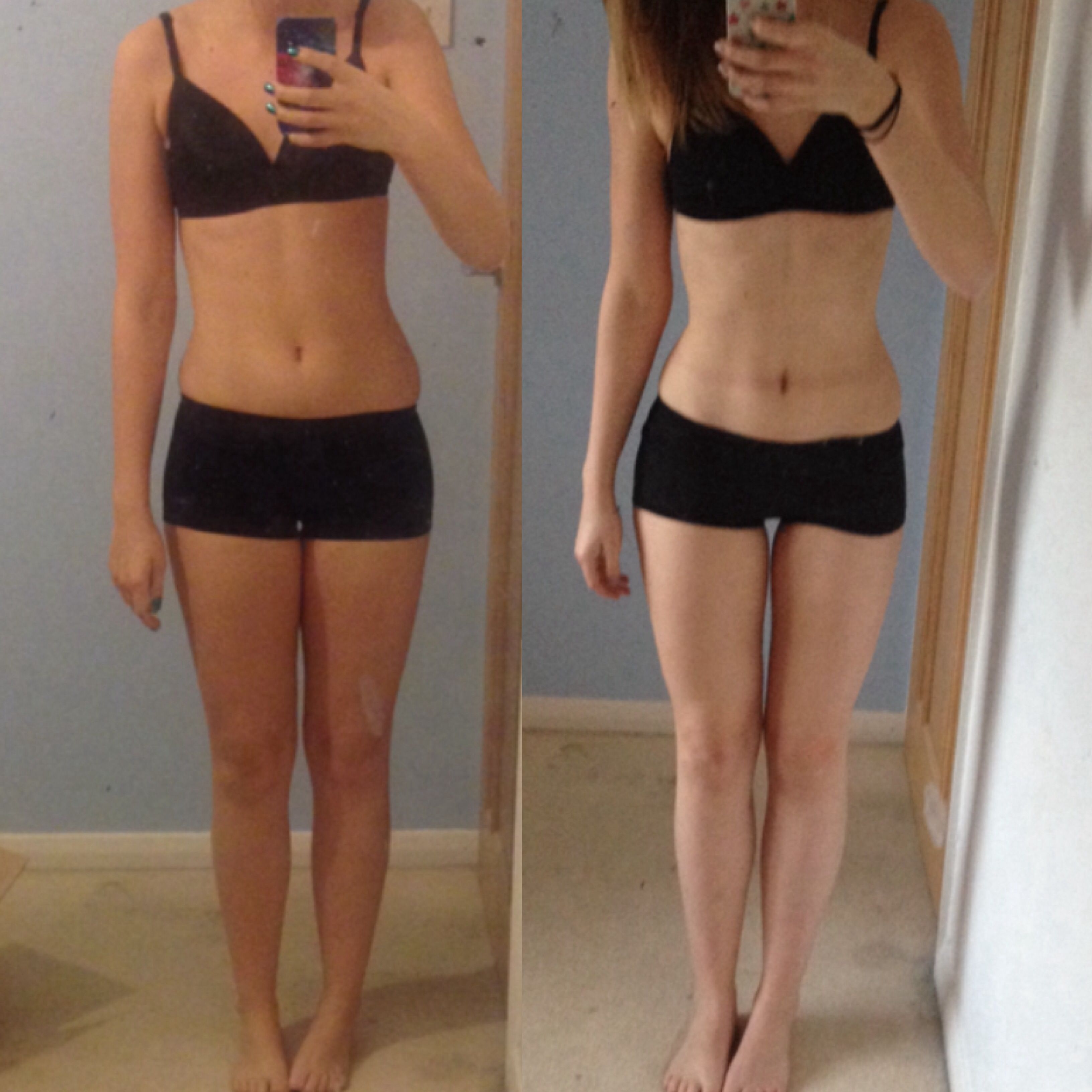 Weight Loss Surgery Cost South Africa Weight loss surgery cost south africa