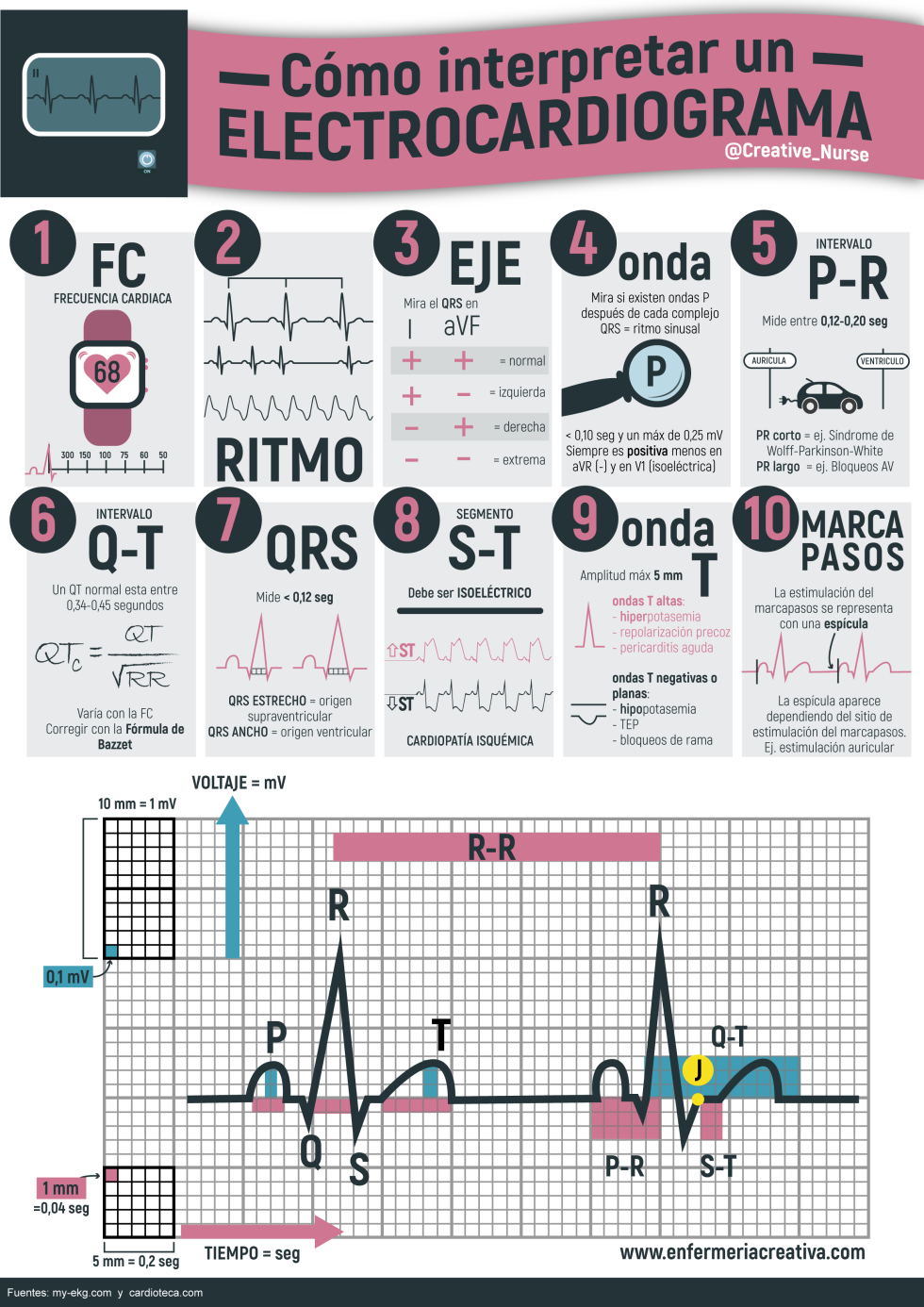 Cómo interpretar un ECG enfermeria creativa Medicine Notes, Vet Medicine, Medicine Studies, Veterinary Medicine, Nursing Tips, Nursing Notes, Cardiac Nursing, Medical Anatomy, Med Student