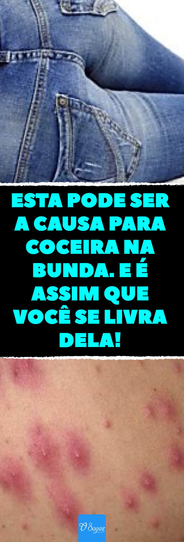 Bunda de macho negro Videos de sexo ao vivo grátis