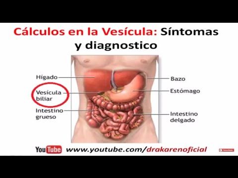 condilomas signes et síntomas de diabetes