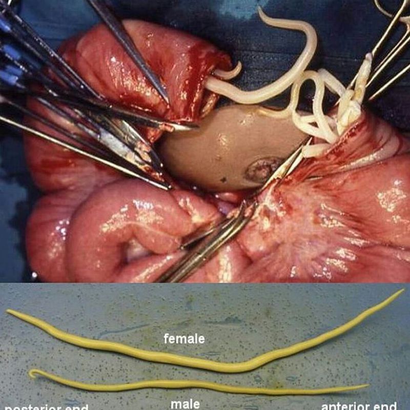 ascaris lumbricoides symptoms and treatment ascaris lumbricoides symptoms and treatment