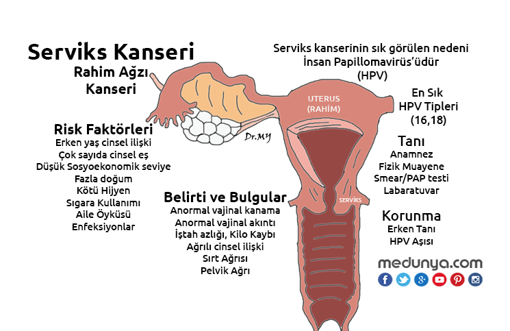Serviks Kanseri Medunya Com