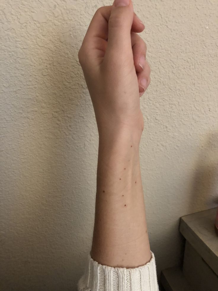 Photo of Cancer Constellation Tattoo Sommersprossen, #Cancer #constellation #constellationtattooneck #freck …