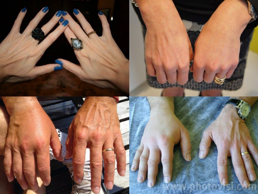 خلطة مدهلة لتسمين اليدين واخفاء العروق بسرعة رهيبة وإلى الأبد Health And Beauty Rings For Men Hands