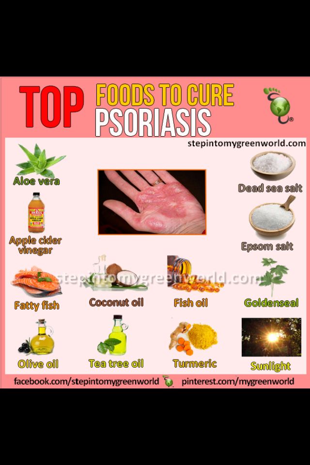 can psoriasis be cured with diet)