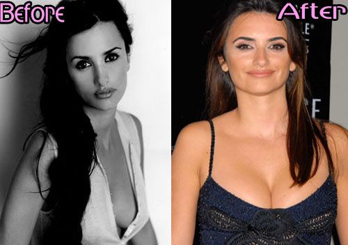 Penelope cruz breast implants something Penelope cruz breast implants