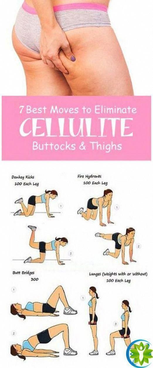 7 Best Exercises To Get Rid of Cellulite On Buttocks And Thighs Fast #fastdiet -... - #buttocks #Cellulite #Exercises #Fast #fastdiet #rid #thighs #CelluliteWorkout #CelluliteCreamThatWorks #CelluliteRemovalTurkey #CelluliteCure #CelluliteRemovalPrice Cellulite Wrap, Causes Of Cellulite, Cellulite Exercises, Reduce Cellulite, Anti Cellulite, Thigh Cellulite, Cellulite Workout, Fitness Workouts, Fitness Motivation