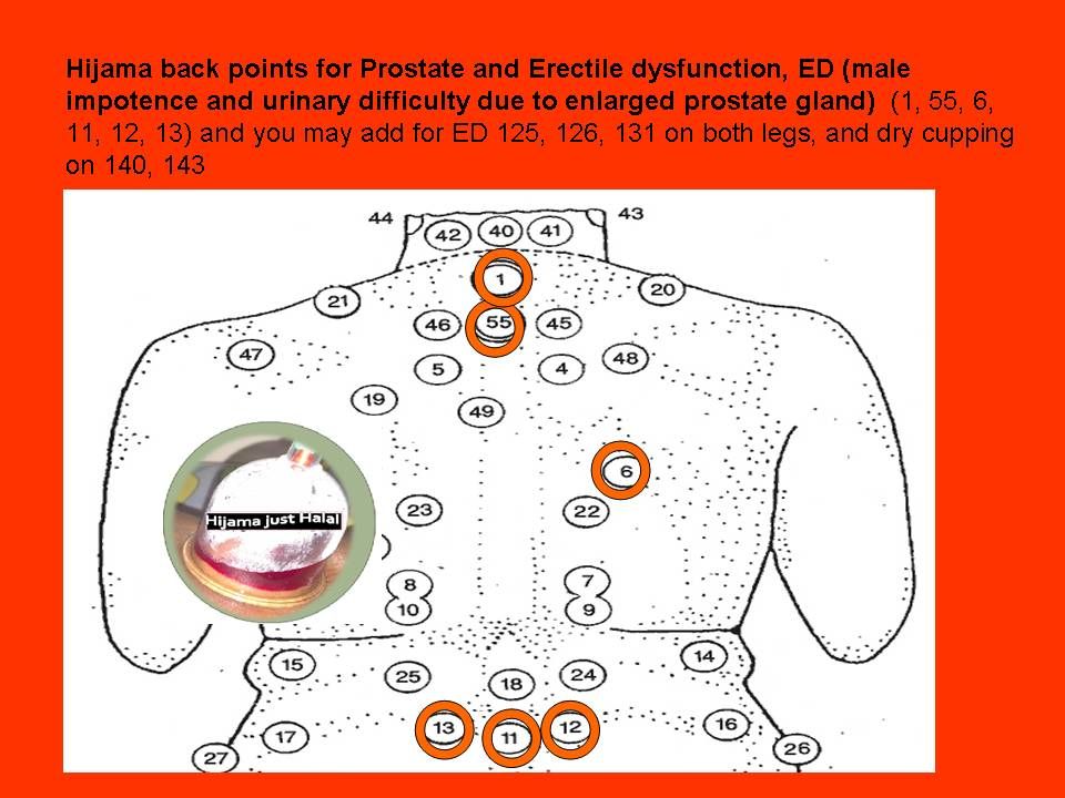 atlas de hijama din prostatită