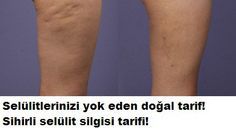 Selulit Silgisi Dogal Tarif Ciltbakimklavuzunuz Health Beauty Makeup Beauty
