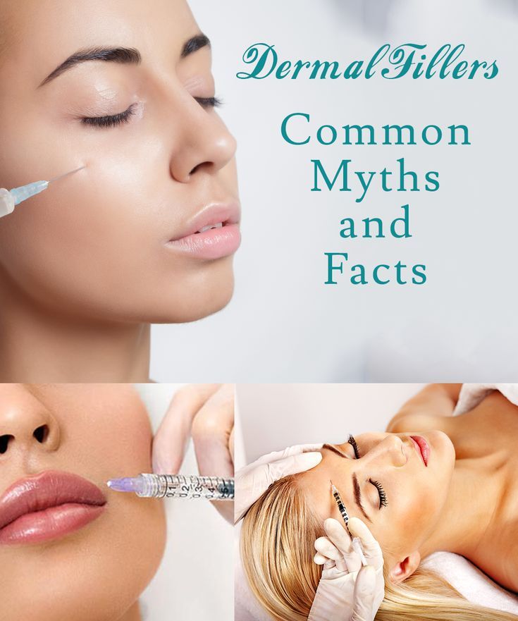 Your best friend swears by the benefits of Dermal fillers