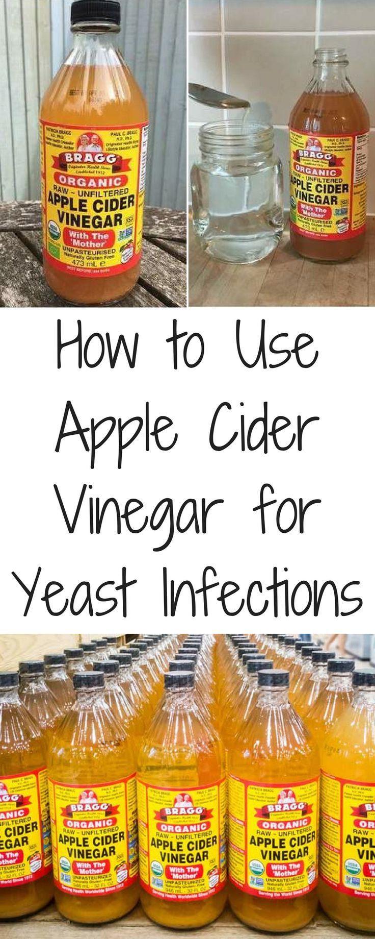 How to Use Apple Cider Vinegar for Yeast Infections