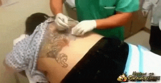 You Can't Un-see What Comes Out Of Her Infected Tattoo | hijabsandclothes | Infected tattoo, Tattoo nightmares, Tattoos