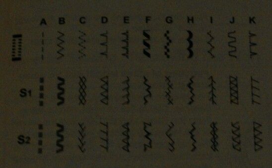 Stitch Options on Singer 2282 Tradition Sewing Machine