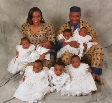Best Friends At Birth Rare Set Of Twins Born Holding Hands