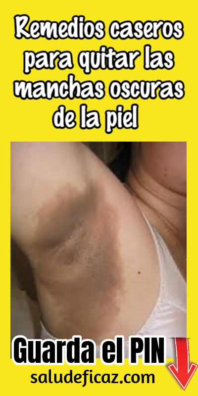 Pin On Remedios Caseros