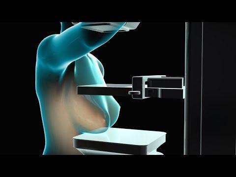 Dissertation on mammograms