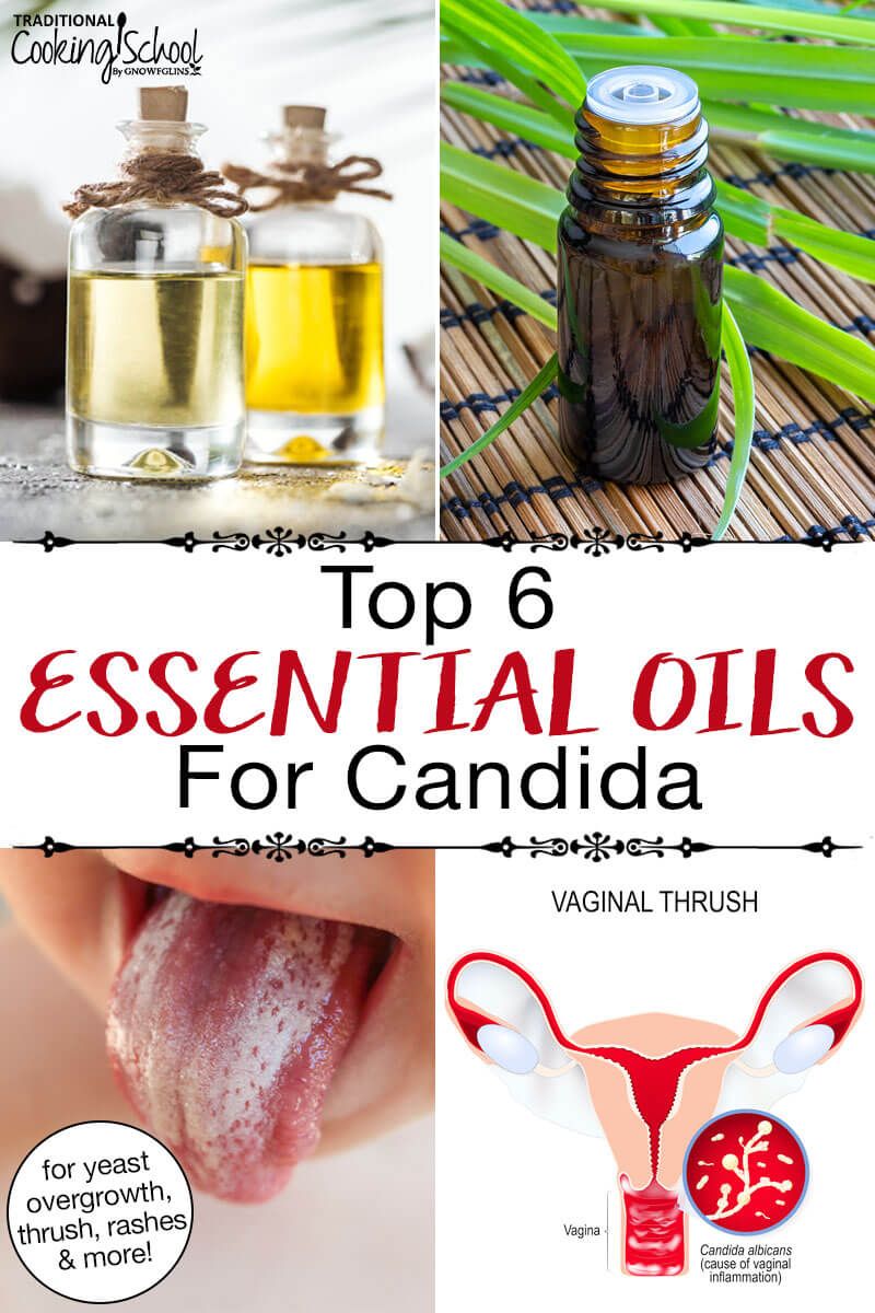 6 Essential Oils For Candida (+ Oral Thrush Mouthwash 6 Essential Oils For Candida (+ Oral Thrush Mouthwash