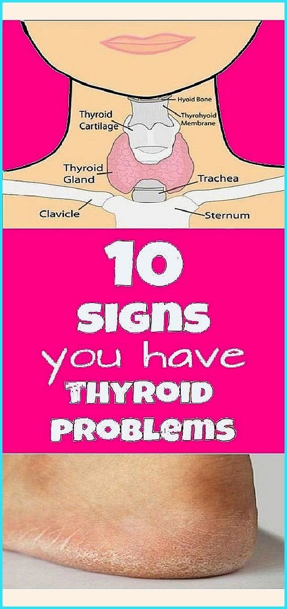 10 Signs You Have a Thyroid Problem and 10 Ways to 10 Signs You Have a Thyroid Problem and 10 Ways to