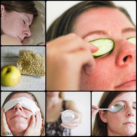 remove black circles under eyes home remedy