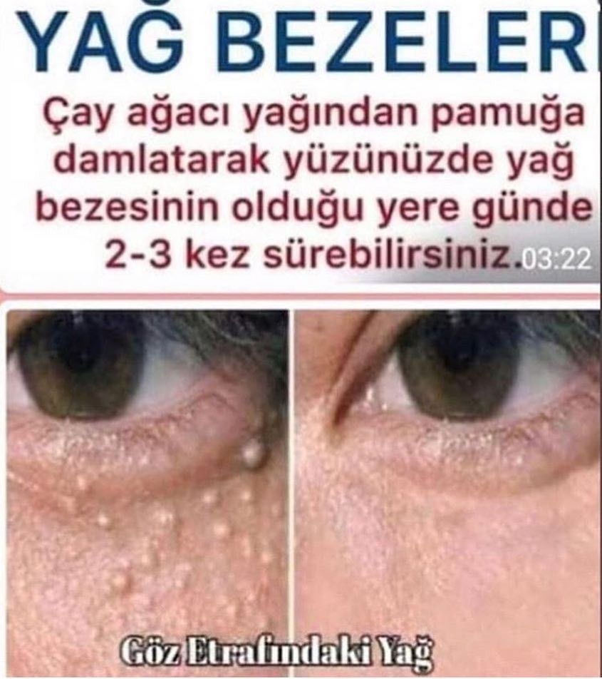 Temizlik Yontemleri Panosundaki Pin Temizlik Yontemleri Panosundaki Pin