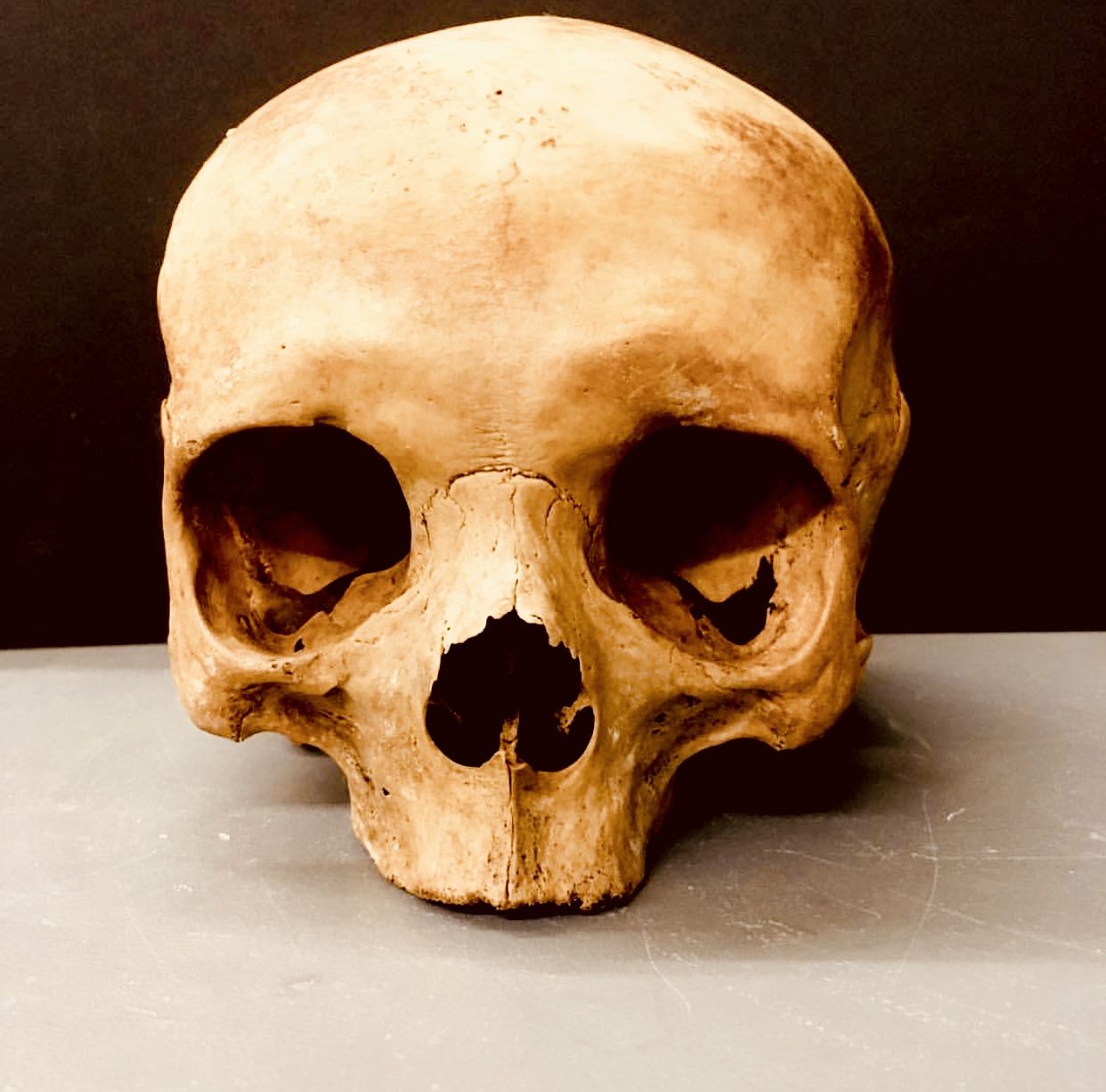 Pin De Derald Hallem En Skull Art Craneo Humano Craneo Calaveras