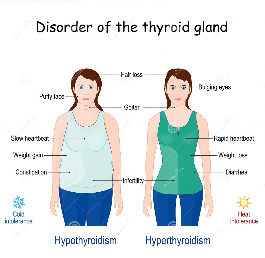 11 supplements to help manage graves hyperthyroidism Artofit 11 supplements to help manage graves hyperthyroidism Artofit